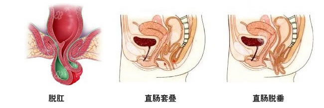 咨询
