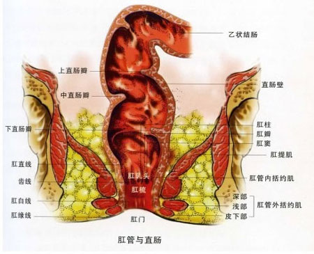 直肠脱垂
