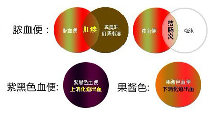 便血症状