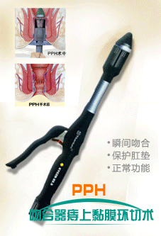 PPH